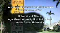 Vote for Karim Damji, University of Alberta: Preventing and Treating Avoidable Blindness from Glaucoma in Sub-Saharan Africa