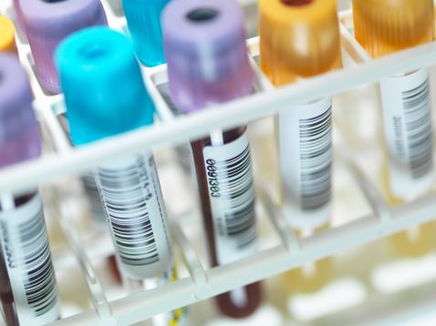 HIV/Aids mortality rate rising by 11pc annually in Pakistan: report