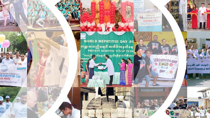 World Hepatitis Day: Aga Khan University Hospital Karachi organising Public Health Awareness Session