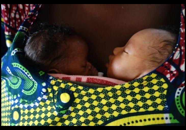 Kangaroo Mother Care Helps Premature Babies Thrive 20 Years Later
