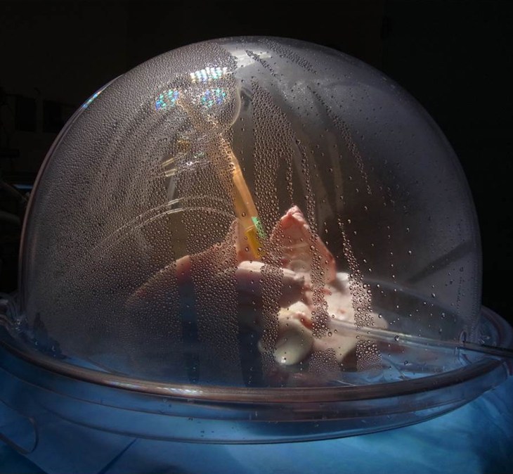 The latest generation ex vivo lung perfusion (EVLP)