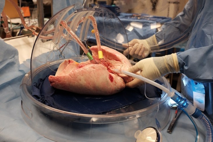 Ex Vivo Lung Perfusion System (EVLP)